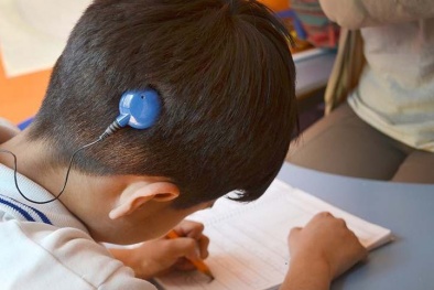 Cảnh báo biến chứng có thể xảy ra khi cấy ốc tai điện tử