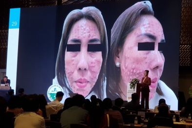 Những nguyên nhân khiến biến chứng thẩm mỹ ngày càng gia tăng