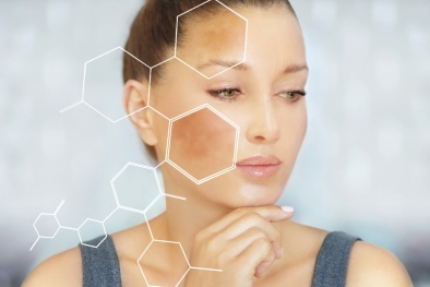 Truyền trắng da có thể biến chứng đe dọa tính mạng