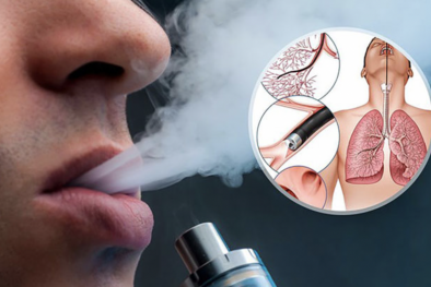 Sử dụng thuốc lá điện tử trong phòng kín thường xuyên có thể dẫn đến tổn thương phổi cấp