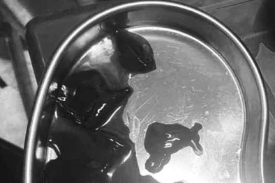 Biến chứng vì sử dụng phương pháp thải độc phản khoa học