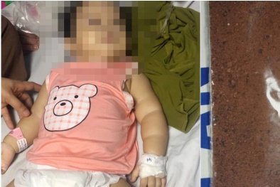 Bé gái bị ngộ độc chì, asen do dùng 'thuốc cam gia truyền' điều trị sốt