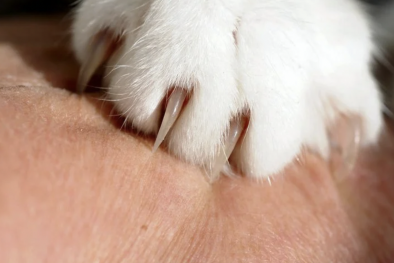 Lở loét nghiêm trọng cánh tay do tự ý bôi thuốc vào vết thương mèo cào