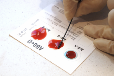 Nghiên cứu mới phát hiện nhóm máu cảnh báo nguy cơ đột quỵ sớm