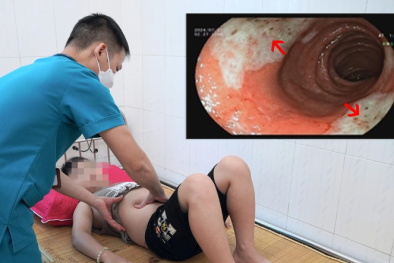 Trẻ bị loét tá tràng do cha mẹ cho uống thuốc hạ sốt ibuprofen không đúng hướng dẫn sử dụng