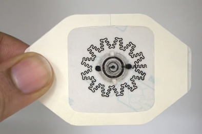 Phát triển ‘băng điện’ chạy bằng nước giúp xử lý vết thương chậm lành