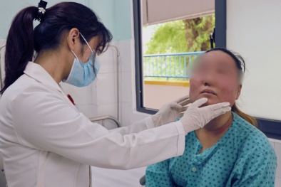 Bội nhiễm, sưng nề da sau khi dùng 'combo tái sinh làn da mới' mua trên mạng