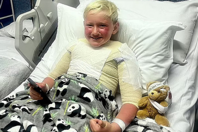 Dùng kem chống nắng cũng có thể gây bỏng do làn da nhạy cảm với thành phần