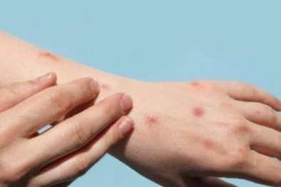 Cẩn trọng với những căn bệnh về da thường gặp sau mùa mưa lũ 