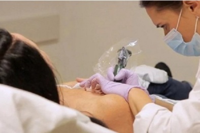 Hoại tử ngực sau khi xăm làm hồng ở một spa từ quảng cáo trên mạng