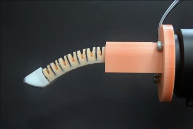 Phát triển 'ngón tay' robot có thể thực hiện kiểm tra sức khỏe định kỳ