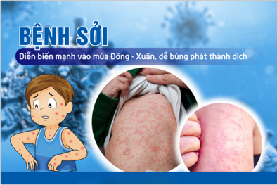 Dịch sởi đang tăng cao, người dân cần chủ động phòng tránh