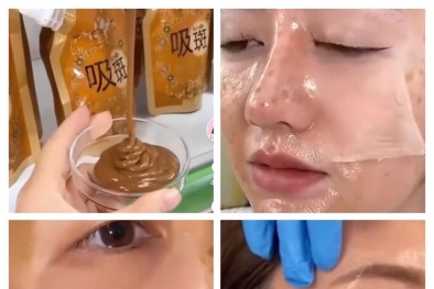 Biến chứng do sử dụng sản phẩm peel da, xóa nám trôi nổi trên mạng