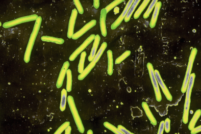 Cẩn trọng mắc bệnh uốn ván nghiêm trọng mặc dù không có vết thương ngoài da