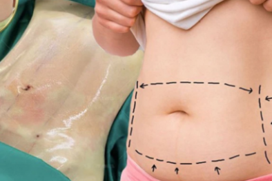 Cẩn trọng với những quảng cáo 'nổ' hình ảnh cắt cả mảng mỡ bụng để giảm cân trên mạng 