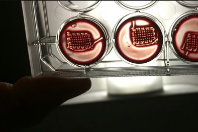 Phương pháp chữa lành vết thương thông qua mô cấy ghép tạo từ máu tự thân