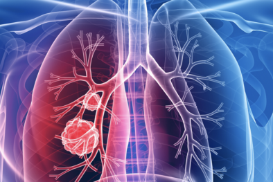 WHO phê duyệt phương pháp đầu tiên chẩn đoán nhanh và chính xác cho bệnh lao