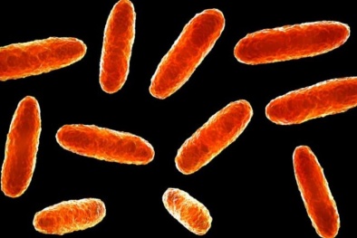 Cảnh báo nguy cơ sức khoẻ do nhiễm vi khuẩn Klebsiella oxytoca