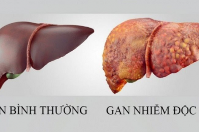 Cách giải độc gan ngày Tết