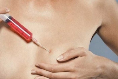 Cảnh báo tình trạng hoại tử ngực do tiêm silicon