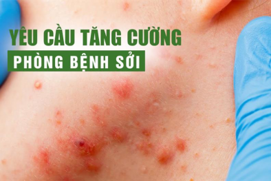 Bộ Y tế yêu cầu có phương án cấp cứu, cách ly khi tăng ca sởi nặng