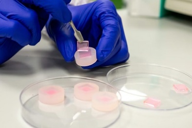 Công nghệ mới điều trị vết thương mãn tính thông qua những chiếc kim siêu nhỏ 