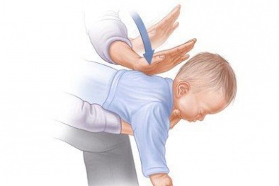 Chuyên gia khuyến cáo cách xử trí, phòng ngừa hóc dị vật ở trẻ