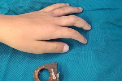 Tai nạn rình rập trẻ em từ những vật dụng quen thuộc trong nhà