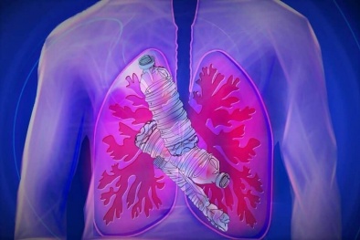 Nguy cơ vô hình từ nhà bếp: Vi nhựa đang 'len lỏi' vào cơ thể bạn mỗi ngày