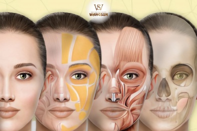 Căng da giấu chỉ Smas: Giải pháp trẻ hóa an toàn, hiệu quả cho làn da tuổi trung niên