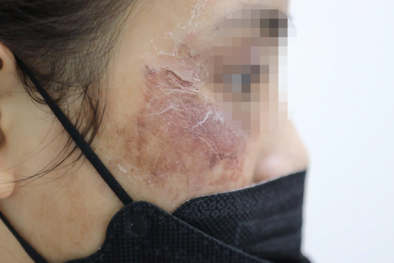 Mỹ phẩm online: Lời quảng cáo ngọt ngào, hiểm họa vô hình