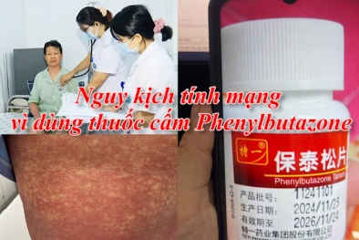 Cảnh báo khẩn: Nguy kịch tính mạng vì dùng thuốc cấm Phenylbutazone