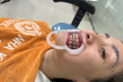 Bi kịch từ những phòng khám nha khoa 'dởm'