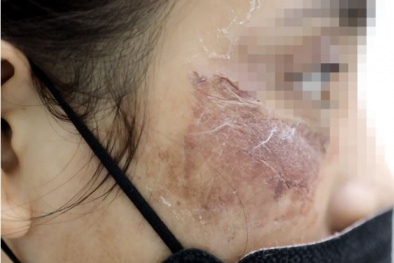 Mỹ phẩm theo trào lưu mạng xã hội: Cái bẫy hủy hoại làn da