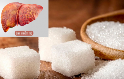 Sử dụng nhiều đường có thể gây xơ gan, ung thư gan